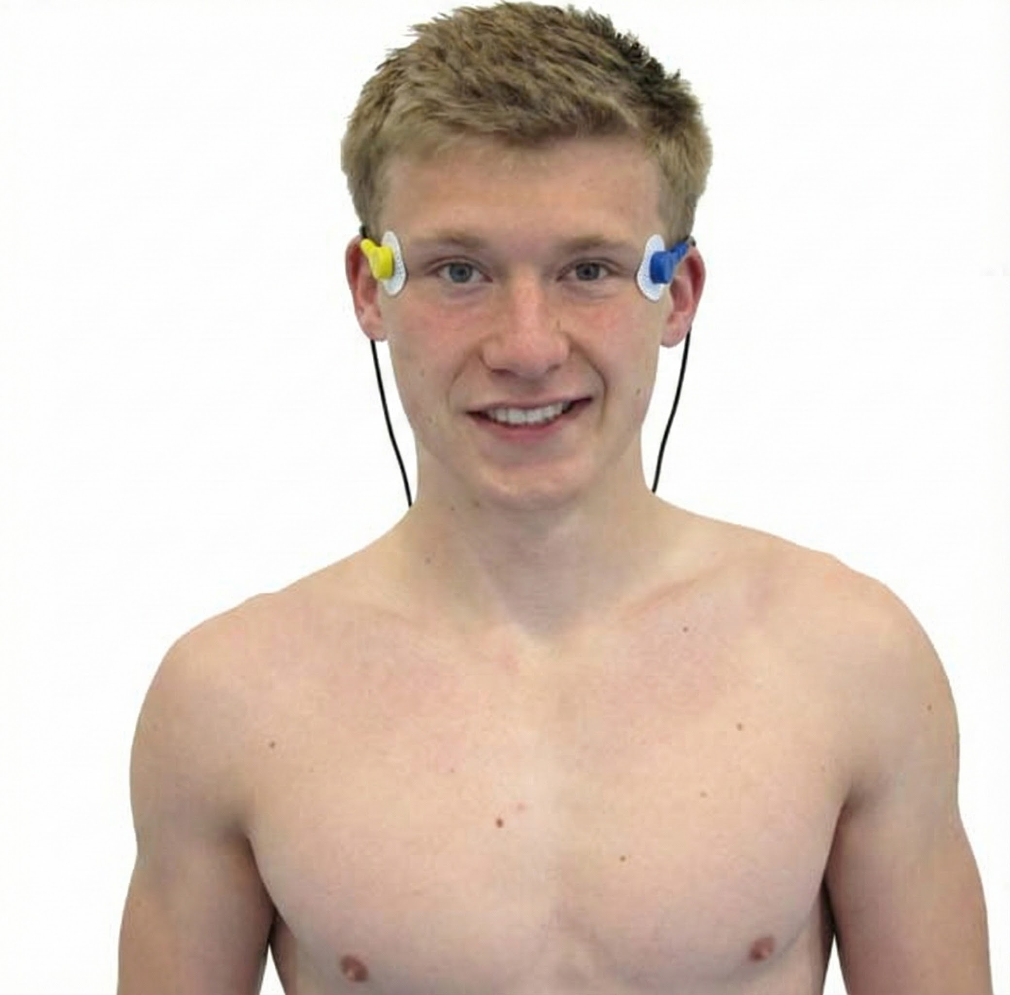 Bilateral temporalis placement